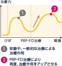 1.安静や、一般的な治療による治癒作用 / 2.PRP-FD治療により再度、治癒作用をアップさせる